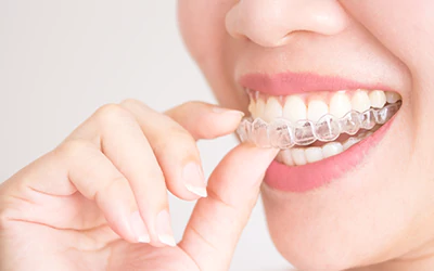 Metal and Ceramic dental braces for maligned teeth